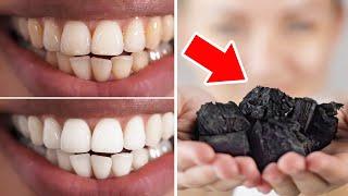 Whiten Your Teeth in Just Few Minutes And Make Yellow Teeth White Natural Remedy