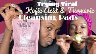 Reviewing Viral Tik Tok Kojic Acid & Turmeric Cleansing Pads by Phor Essentials