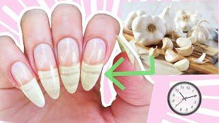 How To Grow Your Nails Fast With Garlic Nail Care Routine