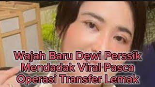 Wajah Baru Dewi Persik Mendadak Viral Pasca Operasi Transfer Lemak