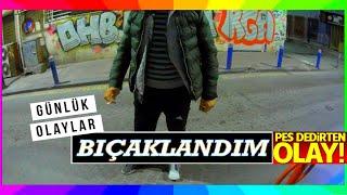 GÜNLÜK OLAYLAR - BIÇAKLANDIM  BAYANLAR VAR MI  YAPTIĞIMI YAPMA  NE DEMEK BOŞ VER  MotoVlog #92