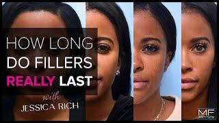 How Long Do Dermal Fillers Last? Dr. Mabrie Discusses Filler Treatments with Jessica Rich