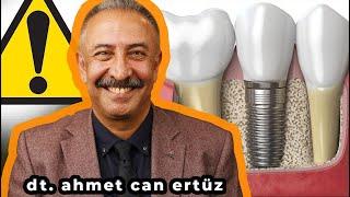 DO NOT Make This Mistake After Getting Dental Implants - Dt. Ahmet Can Ertüz