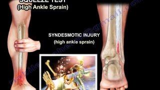 Ankle examination ankle sprain ankle pain - Everything You Need To Know - Dr. Nabil Ebraheim