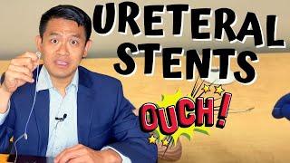 URETERAL STENTS FOR KIDNEY STONE SURGERY  How to remove ureteral stents at home