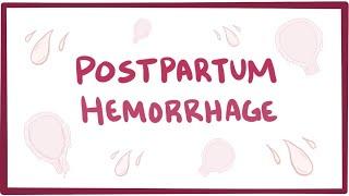 Postpartum hemorrhage - causes symptoms diagnosis treatment pathology