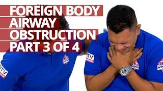 Foreign Body Airway Obstruction Choking Part 3 of 4