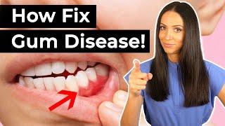 If You Have Gum Disease... Do This