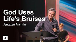 God Uses Lifes Bruises  Jentezen Franklin