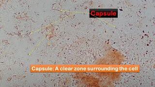 Capsule of bacteria observation in Capsule Stained smears of culture