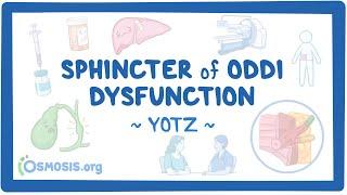 Sphincter of Oddi dysfunction Year of the Zebra 2024