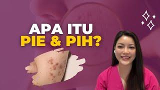 Beauty Tips  Apa itu PIE &  PIH?