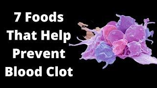 7 Foods That Help Prevent Blood Clot Blood Thinning Foods  VisitJoy