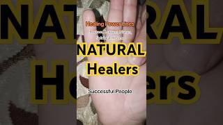 Natural Healers Doctor Nurse Advocate Psychologist Charity Spiritual Healer #palmist #palm #healer