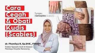 Cara Cegah & Obati Kudis Scabies  dr. Fhemilya R. Sp.DVE.FINSDV