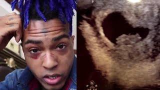 Mother of XXXTentacion Reveals 20-Year-Old Rapper Had Baby on the Way