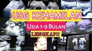 USG Kehamilan Usia 1-9 Bulan Lengkap  Perkembangan Janin dari Minggu ke Minggu