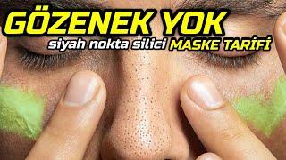 DENEYEN BAYILIYOR Hıphızlı Evde SİYAH NOKTA ve GÖZENEK YOK EDİCİ Maske Tarifi │ Güzellik Bakım