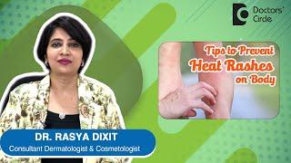 Cure for Heat Rashes  Sweat Rashes - By Dr. Rasya Dixit  Doctors Circle