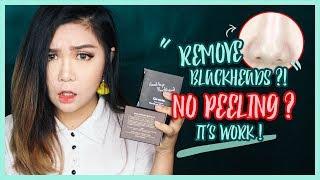 How to Remove Blackhead WITHOUT Peeling Off  Ciracle Goodbye Blackhead Review  thechency