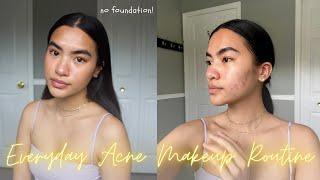 natural everyday acne makeup routine for acne textured skin & post inflammatory pigmentation