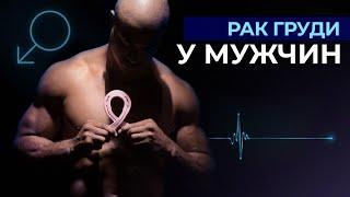 Рак груди у мужчин  Рак грудных желез  Симптомы и лечение