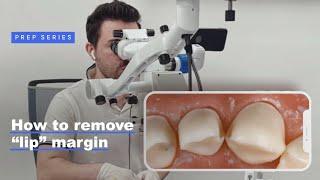 How to remove “lip” margin