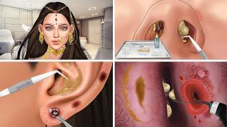 ASMR Ear nose piercing treatment removes animation relax  현실적인 케어 트리트먼트 애니메이션
