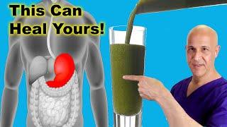 This Juice Healed My STOMACH & GUT...It Can Heal Yours  Dr. Mandell