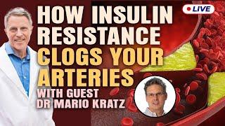 Dr Mario Kratz This Is How Insulin Resistance Clogged Arteries