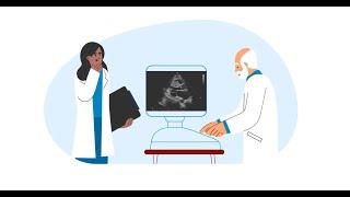 Frequency of Echocardiograms for the Diagnosed and Potential HCM Screening