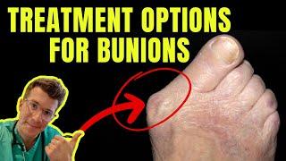 Doctor explains BUNION TREATMENT OPTIONS