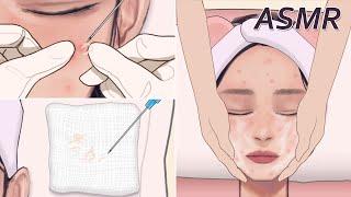 ASMR  Acne Removal Skin Care  スキンケア  여드름 피부 관리  皮膚管理清痘痘粉刺做臉  DADA ASMR