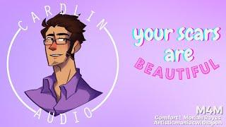 ASMR Roleplay Your Scars Are Beautiful M4M Comfort for body scars Body praise