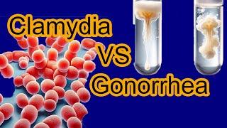 Chlamydia vs Gonorrhea Key Differences Explained