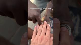 $0.12 street pedicure in Lagos Nigeria