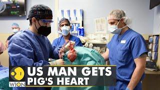 United States First pig to human heart transplant a game-changer for organ transplants  WION