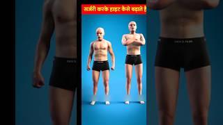 Surgery Se Height Kaise Badaye ️  #viral #experiment #flyingsir #science #medical #facts #youtube