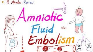 Amniotic Fluid Embolism - ObGyn Pathology Lectures  5-Minute-Review Series