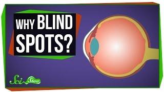 Why Do We Have Blind Spots?