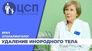 Удаление инородного тела из ЛОР-органов. Рекомендации врача отоларинголога