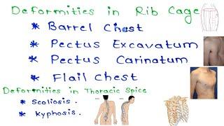 Chest Wall Deformities ScoliosisBarrel Chest Pegion and funnel Chest  Medical Minion Thorax 3