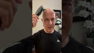 Simple Remedies For Balding & Hair Loss  Dr. Mandell