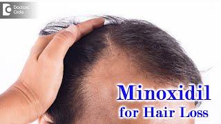 Right way to use MINOXIDIL SOLUTION for HAIR LOSSEXPERT ADVICE-Dr.Deepak P Devakar Doctors Circle