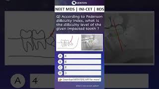 NEET MDS  INI-CET MDS  PSC  BDS - Most Important Questions  #neetmds2025 #mdsprep