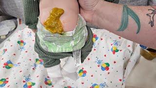 Huge Diaper Blowout Poop Explsion for silicone baby doll nlovewithreborns2011