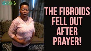 THE FIBROIDS FELL OUT AFTER PRAYER  Miracle Testimony