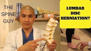 Lumbar Disc Herniation Part 2 How do you know if you have one?