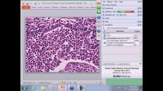 Medical School Pathology 2013 Season Session #22 Lower Urinary and Male II and Lab