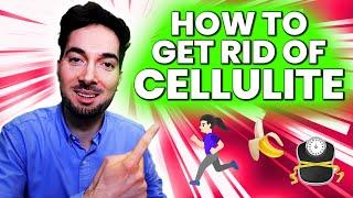 How To Get Rid Of Cellulite Treatment and Removal Medical Info